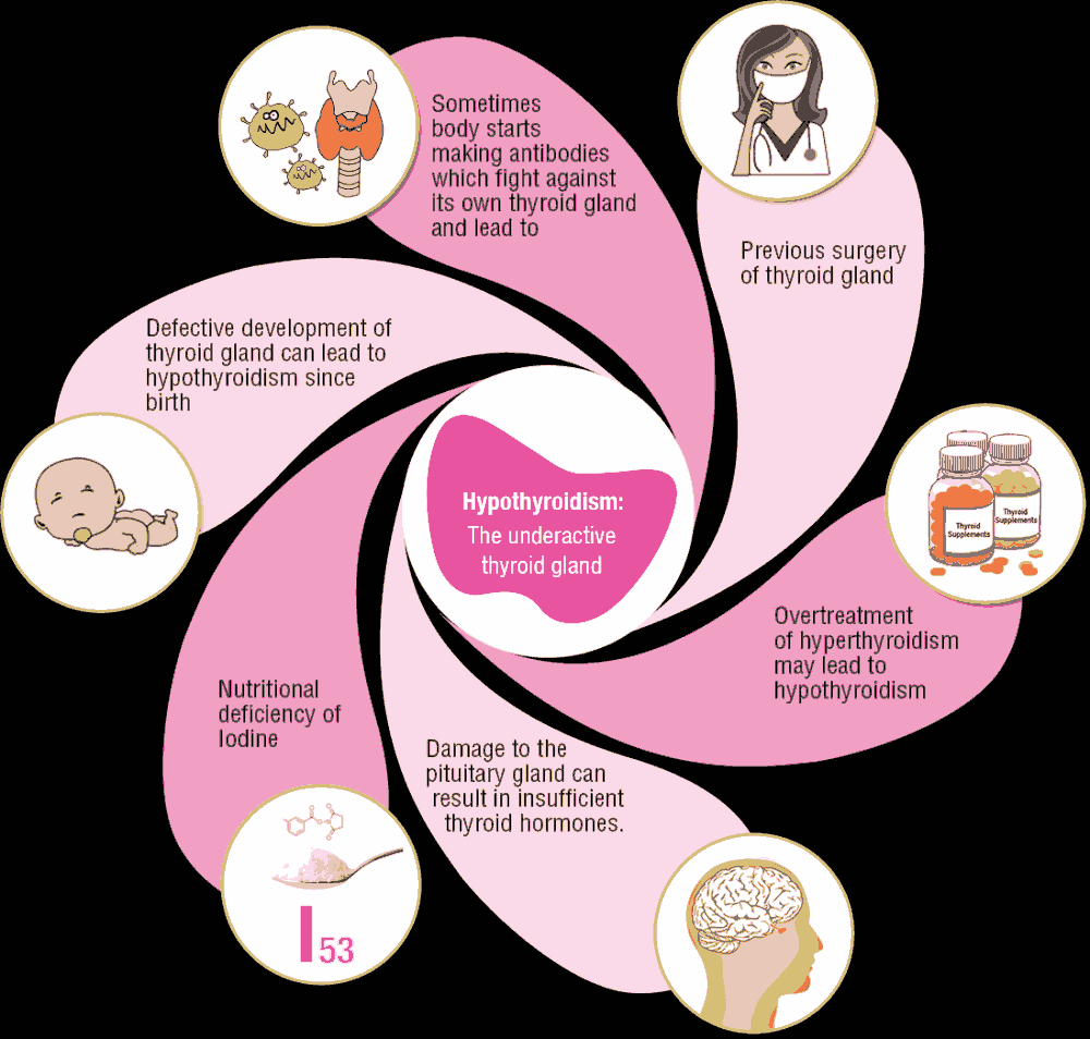 Causes of hypothyroidism