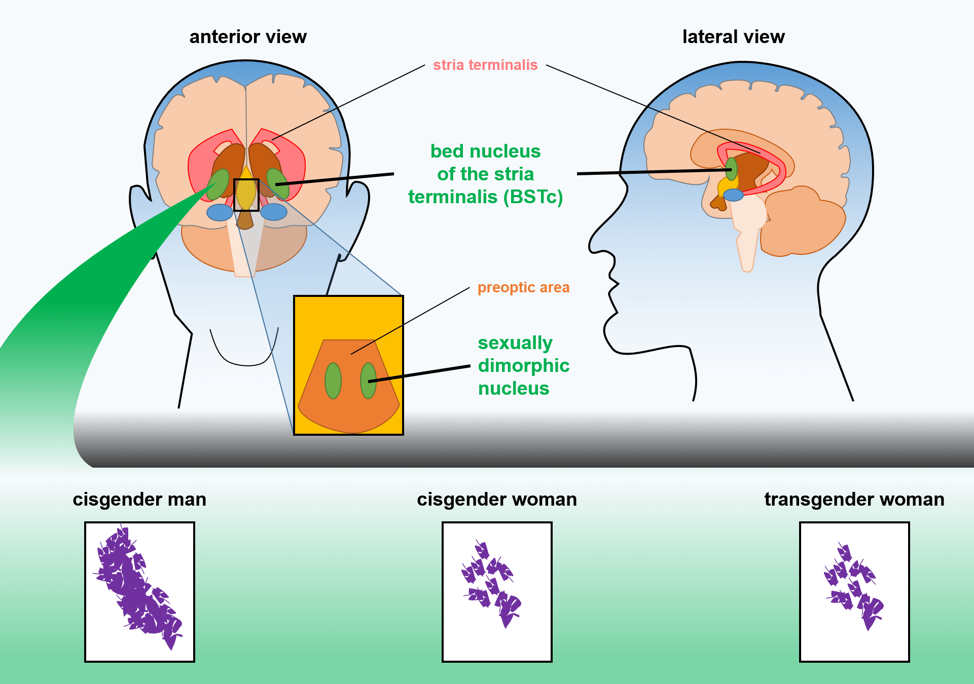 trans people brain